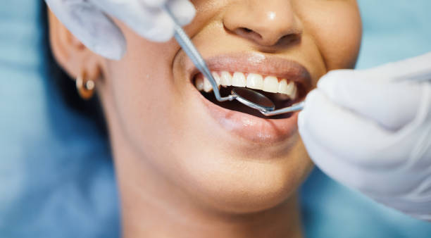 Best Emergency Tooth Extraction in Riverview, MO