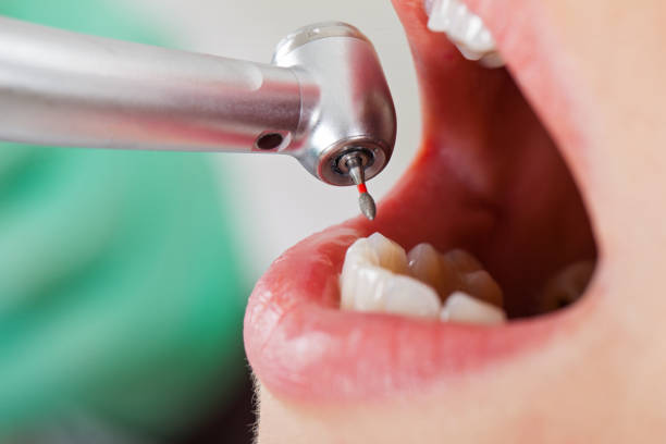 Best Pediatric Emergency Dentist in Riverview, MO